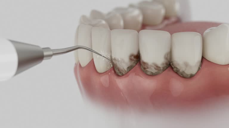 Trusted Dental Crowns And Bridges service in Harmony, RI - Dentist Open Now